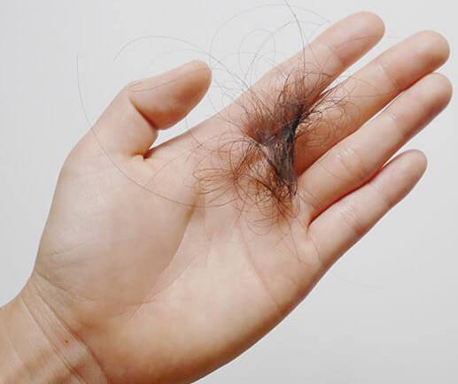 Beberapa Faktor Mempengaruhi Kerontokan Rambut