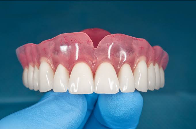 Pendaftaran Pemasangan Gigi Gratis Pemko Pekanbaru Dibuka, Berikut Linknya